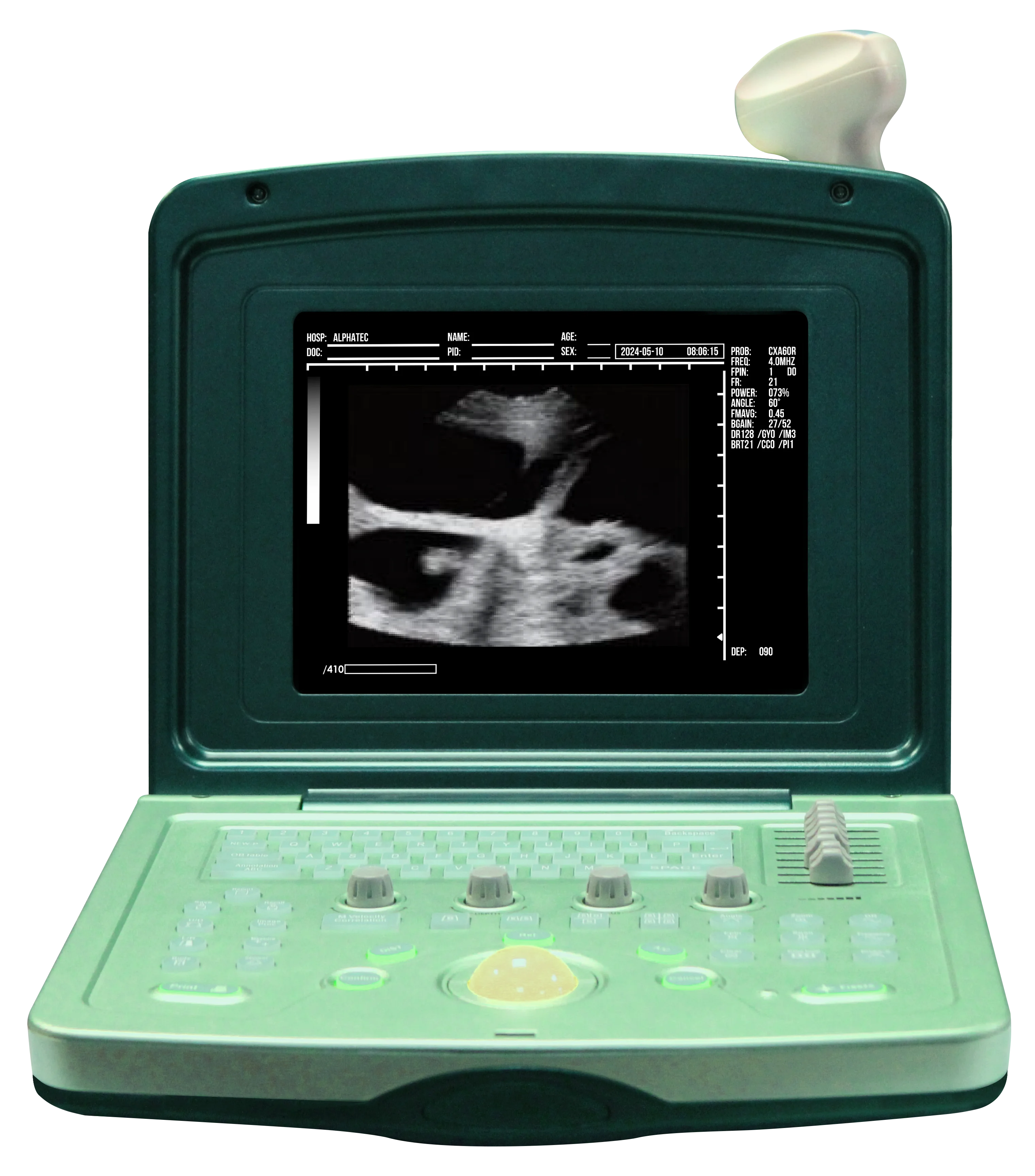 Aetron® ecógrafo veterinario B-ultrasonido Alphatec Scientific� Vet